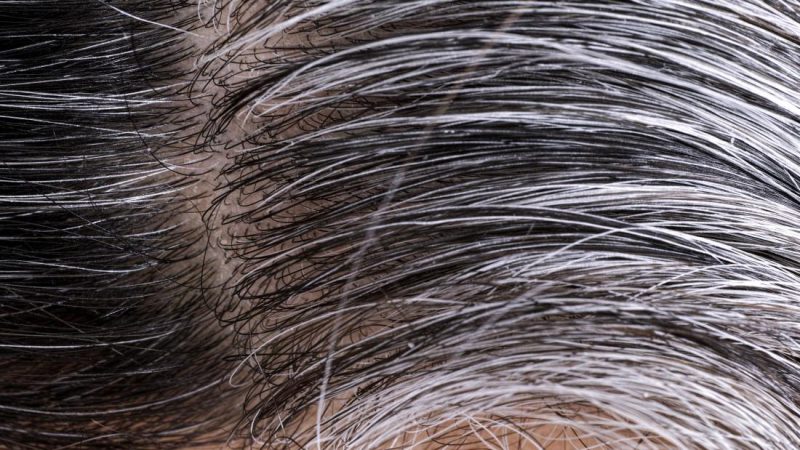 Wellhealthorganic.com/know-the-causes-of-white-hair-and-easy-ways-to-prevent-it-naturally